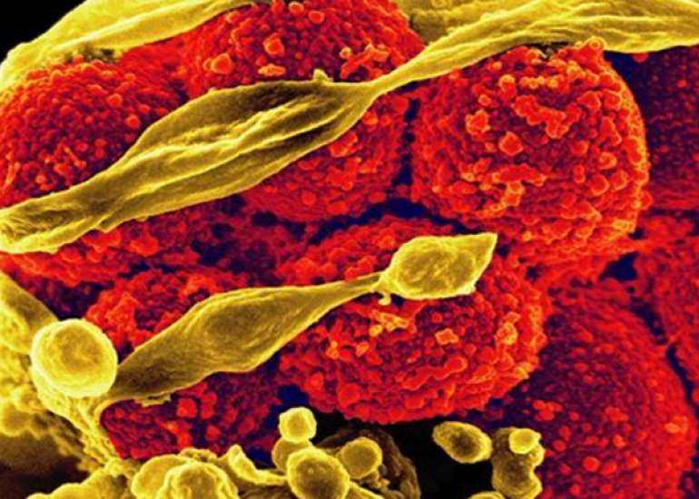 What are the common antibiotics showing resistance in India?