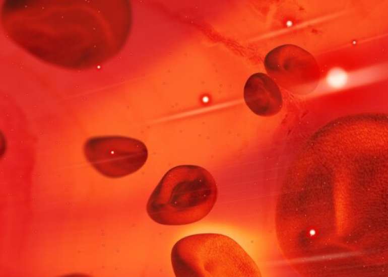 सिकल सेल एनीमिया क्या है? कारण, लक्षण और इलाज | Sickle Cell Anemia in Hindi