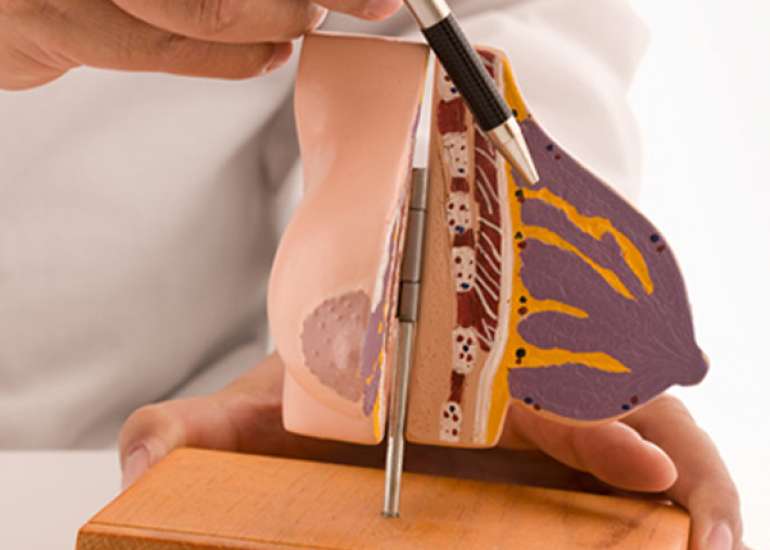 What are some other Risk factors in Breast Cancer?