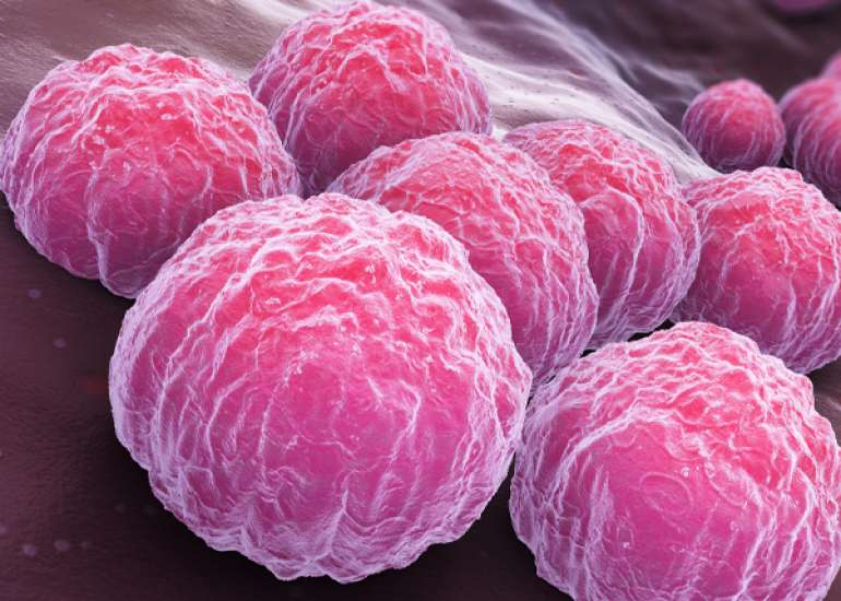 STD In Men And Women: Chlamydia