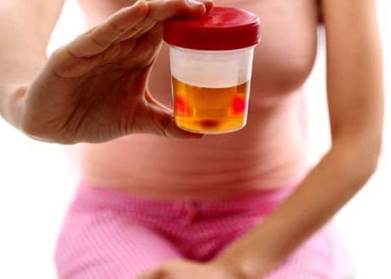 हेमट्यूरिया – पेशाब में खून आना कितना गंभीर? कारण, लक्षण और उपचार |  Hematuria (Blood in Urine) in Hindi