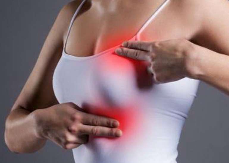 What are the symptoms of Breast Cancer?