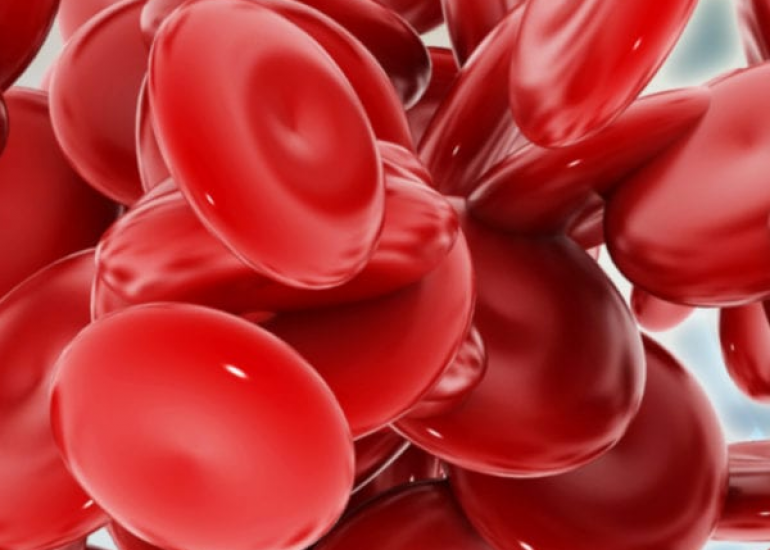 Thalassemias: Types, Symptoms, and Diagnosis