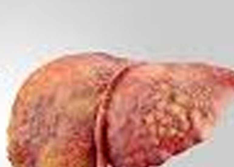 The Diagnostic Value of Serial SGOT and SGPT Monitoring in Chronic Liver Diseases