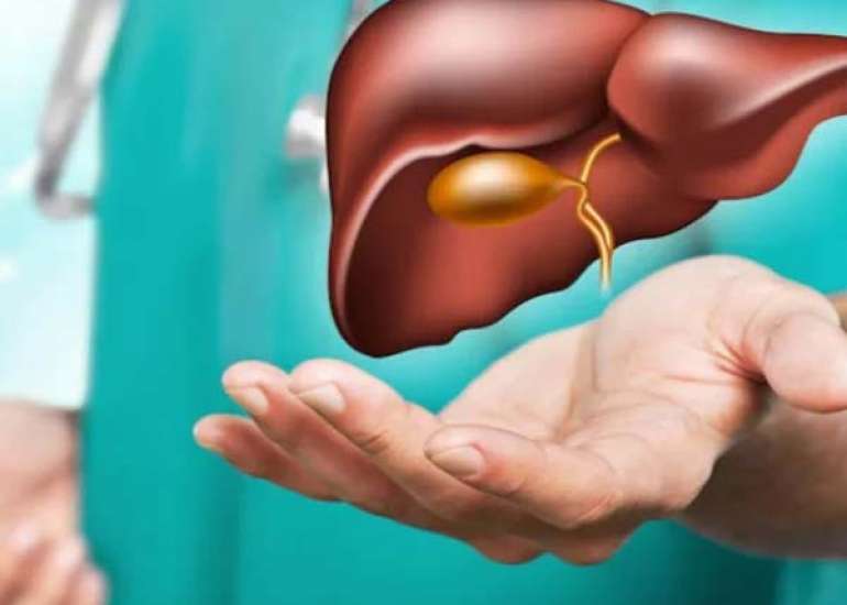 The Role of Nutrition in Promoting Liver Health