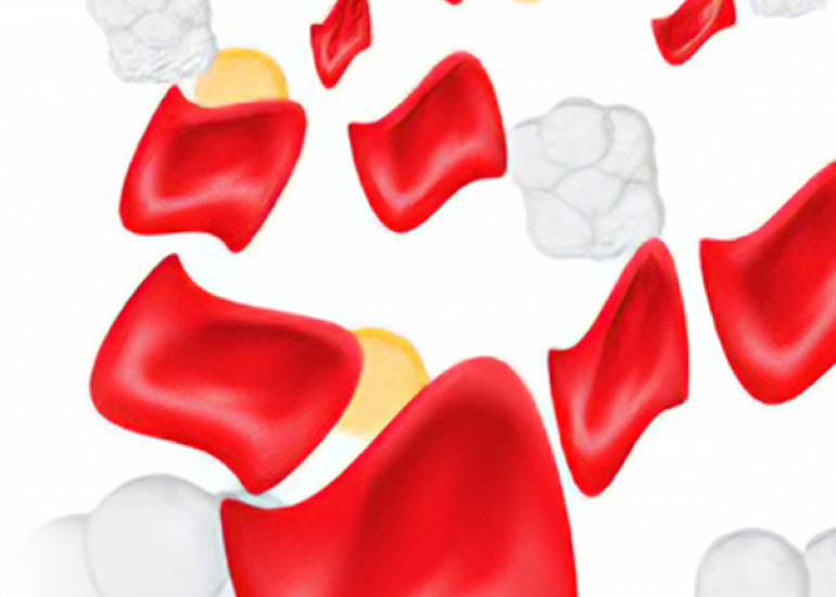 Treatment Strategies for Beta Thalassemia: Blood Transfusions, Chelation Therapy, and Gene Therapy