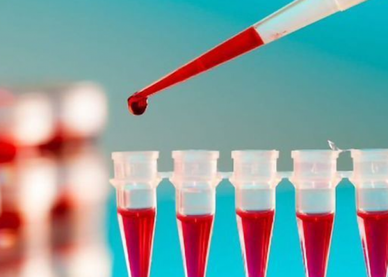 एसजीओटी और एसजीपीटी को समझे: परिणामों का क्या मतलब है?