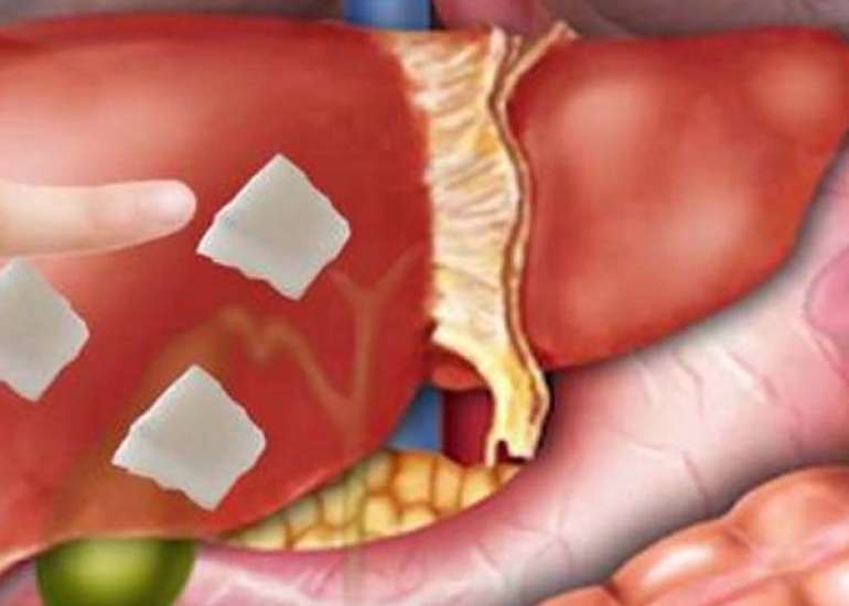 लिवर के कार्य को समझे: आपके शरीर में महत्वपूर्ण अंग 