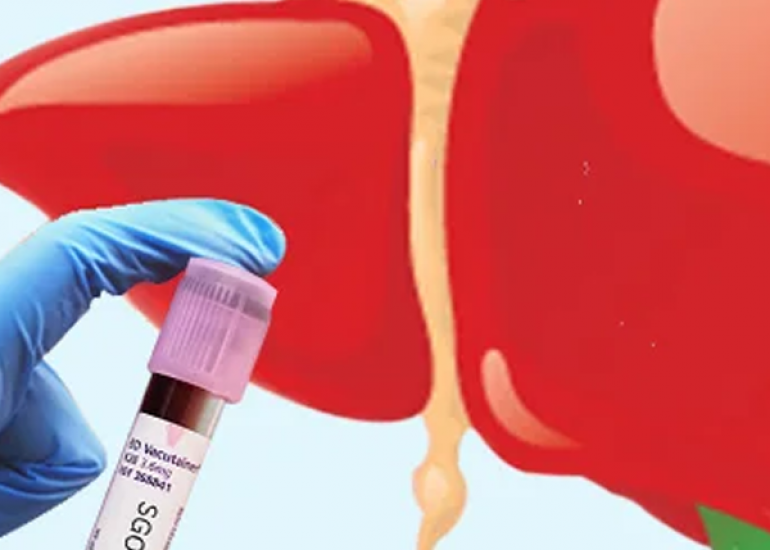 Understanding SGOT and SGPT: What Do the Results Mean?