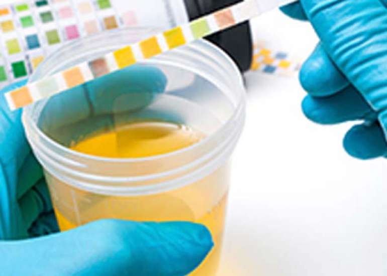 Rethinking Urine Culture Cutoffs for UTI Diagnosis in Young Children