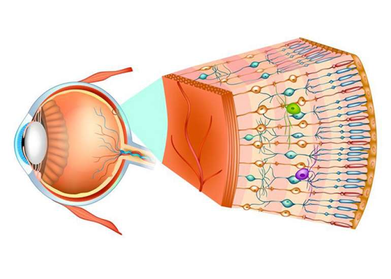 What are various retinal diseases?