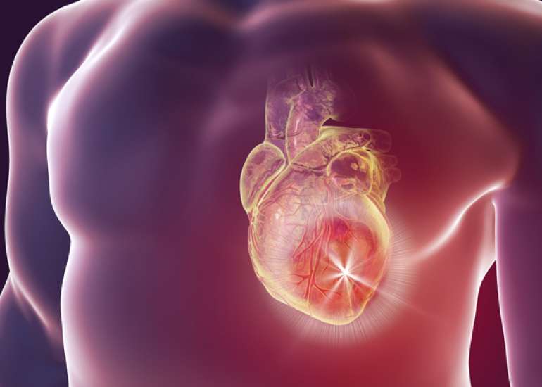 कार्डियक ट्यूमर क्या हैं? कारण, लक्षण और इलाज | What are Cardiac Tumors in Hindi