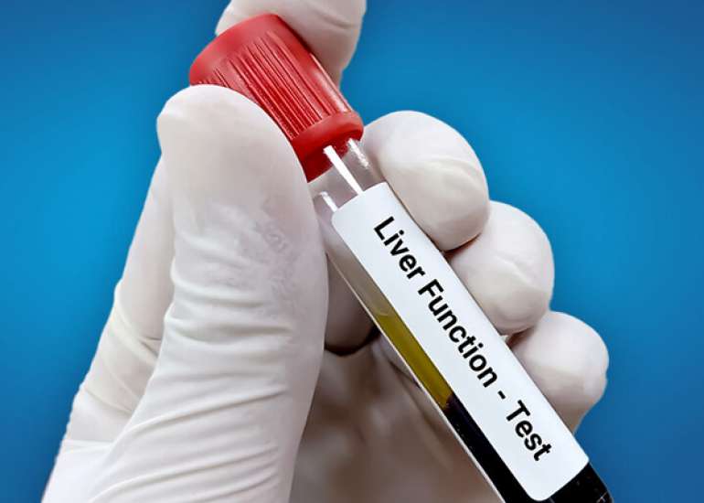 लिवर फंक्शन टेस्ट क्या हैं? | What are Liver Function Tests in Hindi