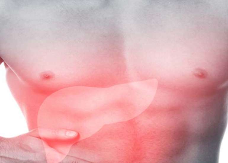 लिवर के घाव क्या हैं? कारण, लक्षण और इलाज | What are Liver Lesions in Hindi