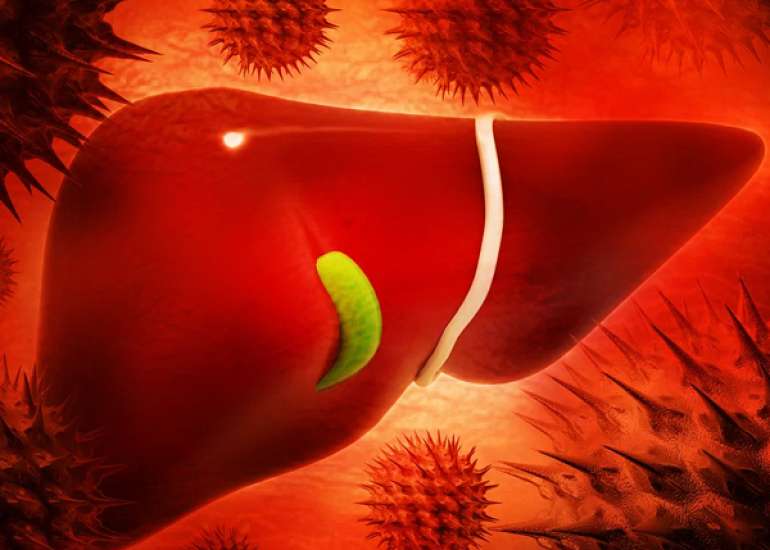 ऑटोइम्यून हेपेटाइटिस क्या है? कारण, लक्षण और इलाज | What is Autoimmune Hepatitis in Hindi