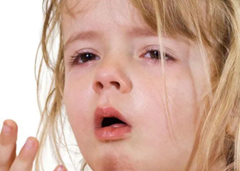 क्रुप क्या है? कारण, लक्षण और इलाज | What is Croup in Hindi