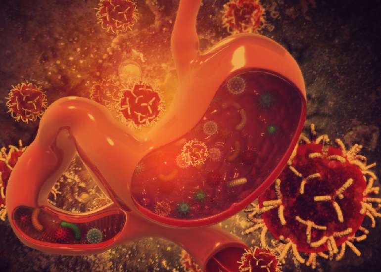 साइक्लोस्पोरियासिस क्या है? कारण, लक्षण और इलाज | What is Cyclosporiasis in Hindi