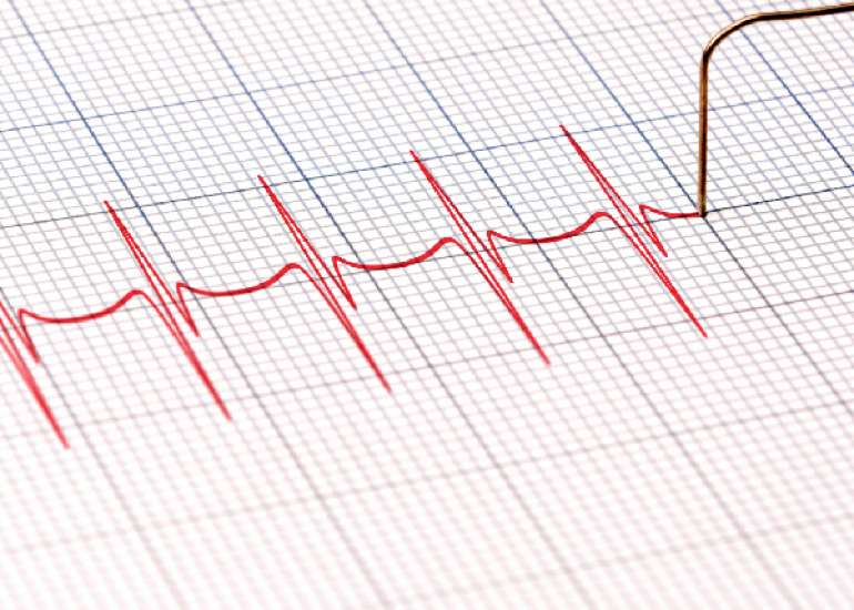 एक्टोपिक दिल की धड़कन क्या है? कारण, लक्षण और इलाज | What is Ectopic Heartbeat in Hindi