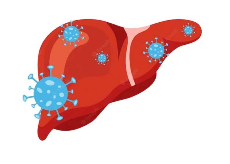 हेपेटाइटिस सी क्या है? कारण, लक्षण और इलाज | What is Hepatitis C in Hindi