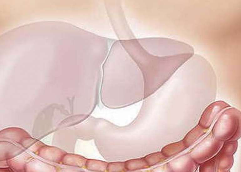 हेपेटाइटिस डी क्या है?  कारण, लक्षण और इलाज | What is Hepatitis D in Hindi