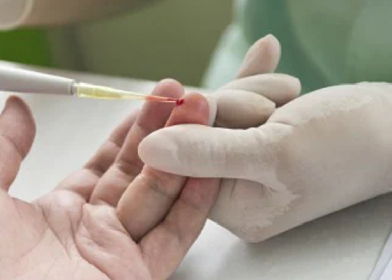 तरल बायोप्सी क्या है? | What is Liquid Biopsy in Hindi