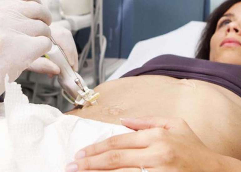 लिवर बायोप्सी क्या है? | What is Liver Biopsy in Hindi