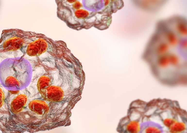 मायलोपैथी क्या है? कारण, लक्षण और इलाज | What is Myelopathy in Hindi