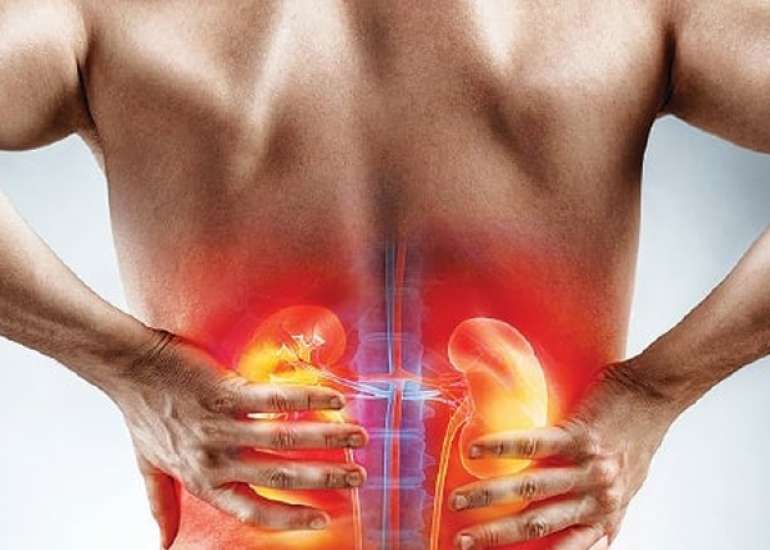 अंग विफलता क्या है? | What is Organ Failure in Hindi