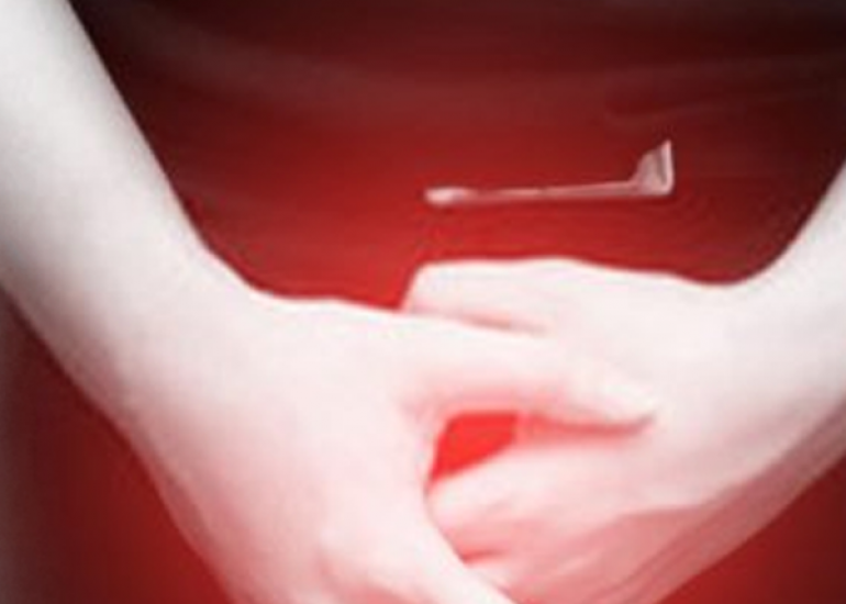 पोस्टहाइटिस क्या है? कारण, लक्षण और इलाज | What is Posthitis in Hindi