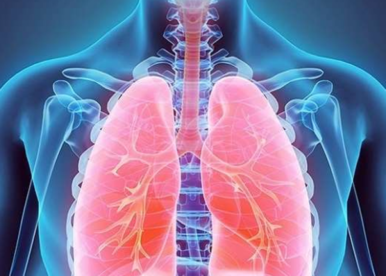 आवर्तक श्वसन पेपिलोमाटोसिस क्या है? कारण, लक्षण और इलाज |  What is Recurrent Respiratory Papillomatosis in Hindi