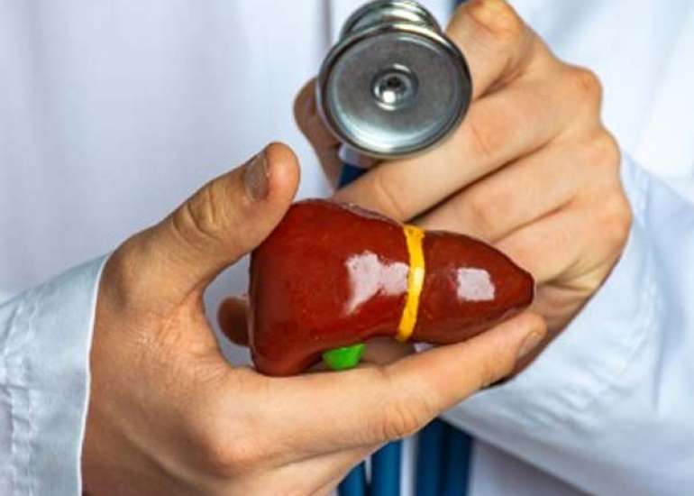 टॉक्सिक हेपेटाइटिस क्या है? कारण, लक्षण और इलाज | What is Toxic Hepatitis in Hindi