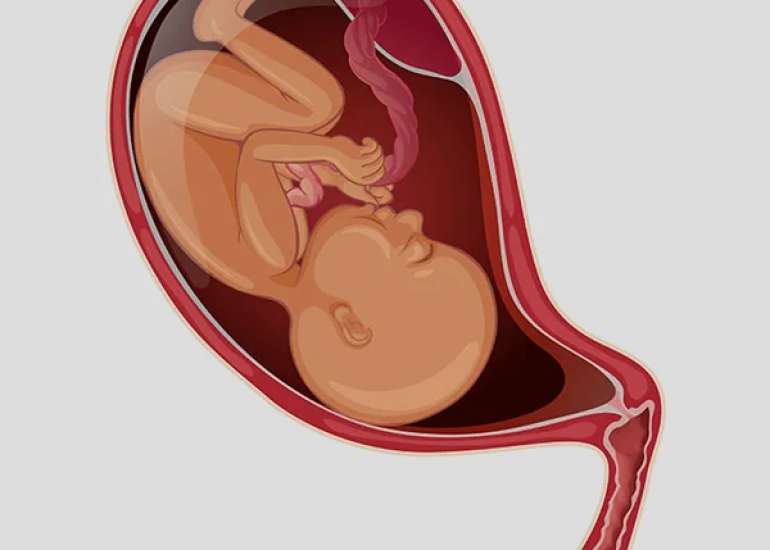 वासा प्रीविया क्या है? | What is Vasa Previa in Hindi