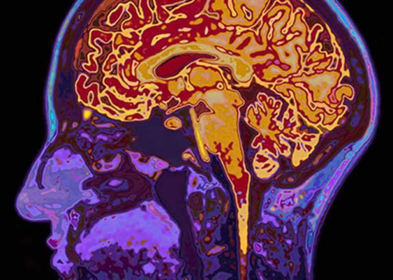 What are the new treatment modalities in dementia?