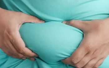 Image An insight into obesity in Type 2 Diabetic patients