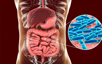 Image Ginger and the Gut Microbiota: A Natural Strategy Against Obesity