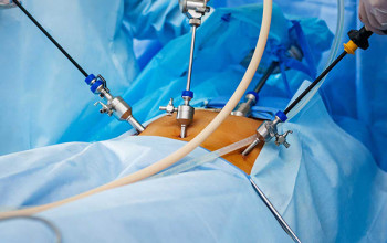 Image Advantage and Disadvantage of Laparoscopic Surgery?