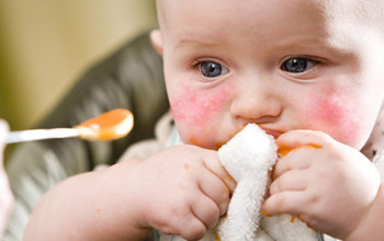 Image Can a food allergy also cause a blocked or runny nose in my child?