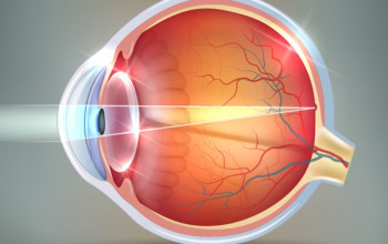 Image Common Eye Conditions and Diseases