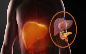 Image Diagnosis of Alcoholic Liver Disease