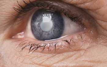Image Does every patient of glaucoma require treatment?
