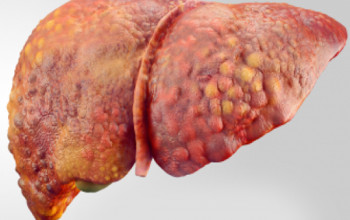 Image For an executive health checkup, what is the preferred liver function test?