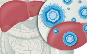 Image Hepatitis in Special Population