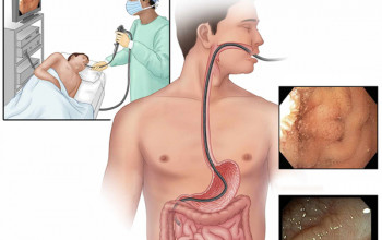 Image How to know if you have Celiac Disease?