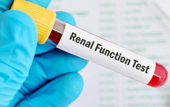 Image I have diabetes, how often should I get renal function test done?
