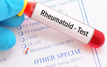 Image Is Rheumatoid factor a diagnostic test for rheumatoid arthritis?