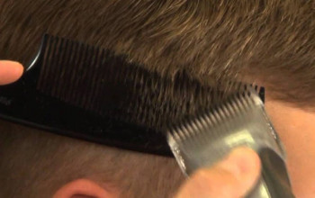 Image Is it necessary to cut hair with a razor before any surgery?