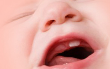Image Is it true that breathing through the mouth can cause dry mouth in my baby?