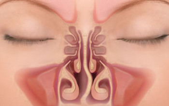 Image Is nasal blockage a common problem?