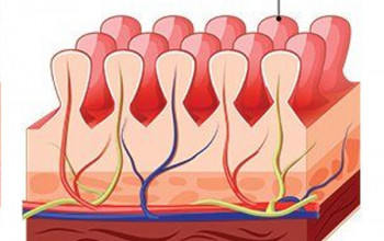 Image What is celiac disease?