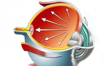 Image What is glaucoma and how prevalent is it?
